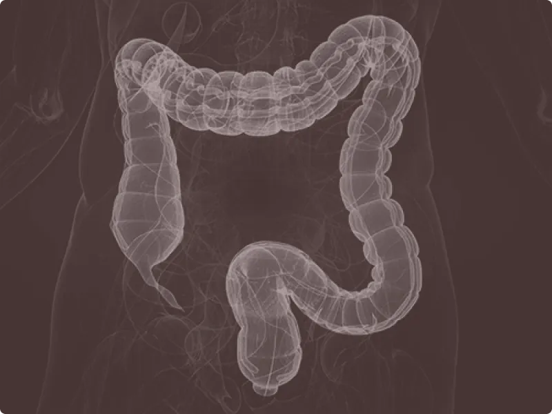 Detailed anatomical illustration focusing on the human large intestine, showing the colon and surrounding structures.