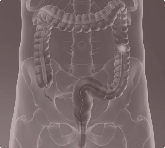 Anatomical illustration of the human colon and large intestine, focusing on the structure and layout of the digestive system.