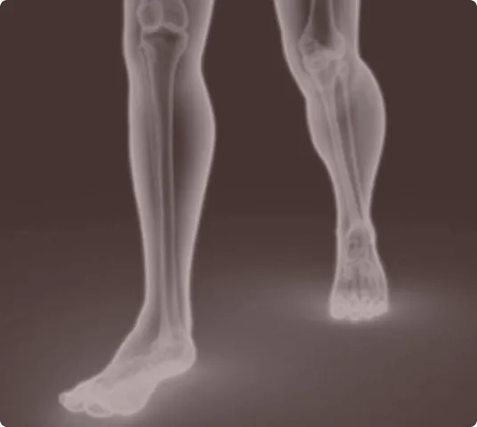 Digital X-ray style illustration showing the lower limbs, highlighting the bones, joints, and skeletal structure of the human legs.