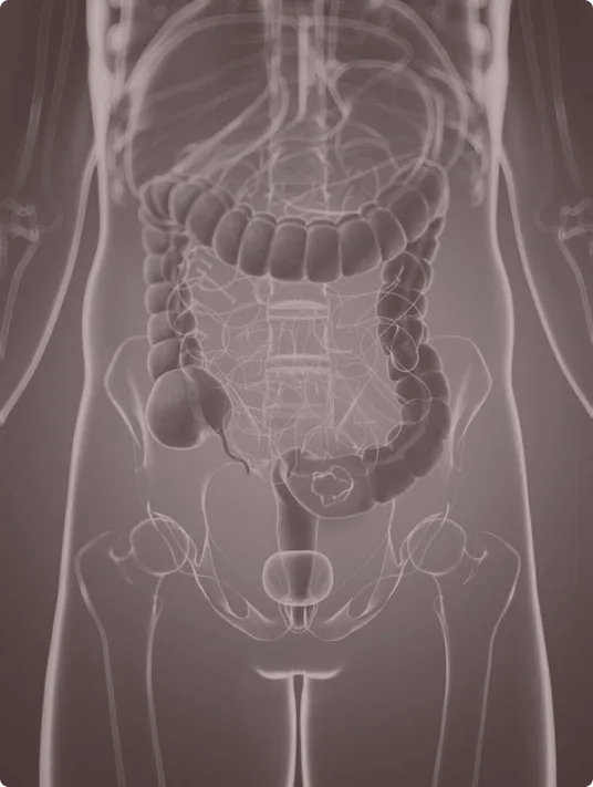 Anatomical illustration of the human digestive system, showing the intestines, colon, and pelvic region with a highlighted focus on the lower abdomen.