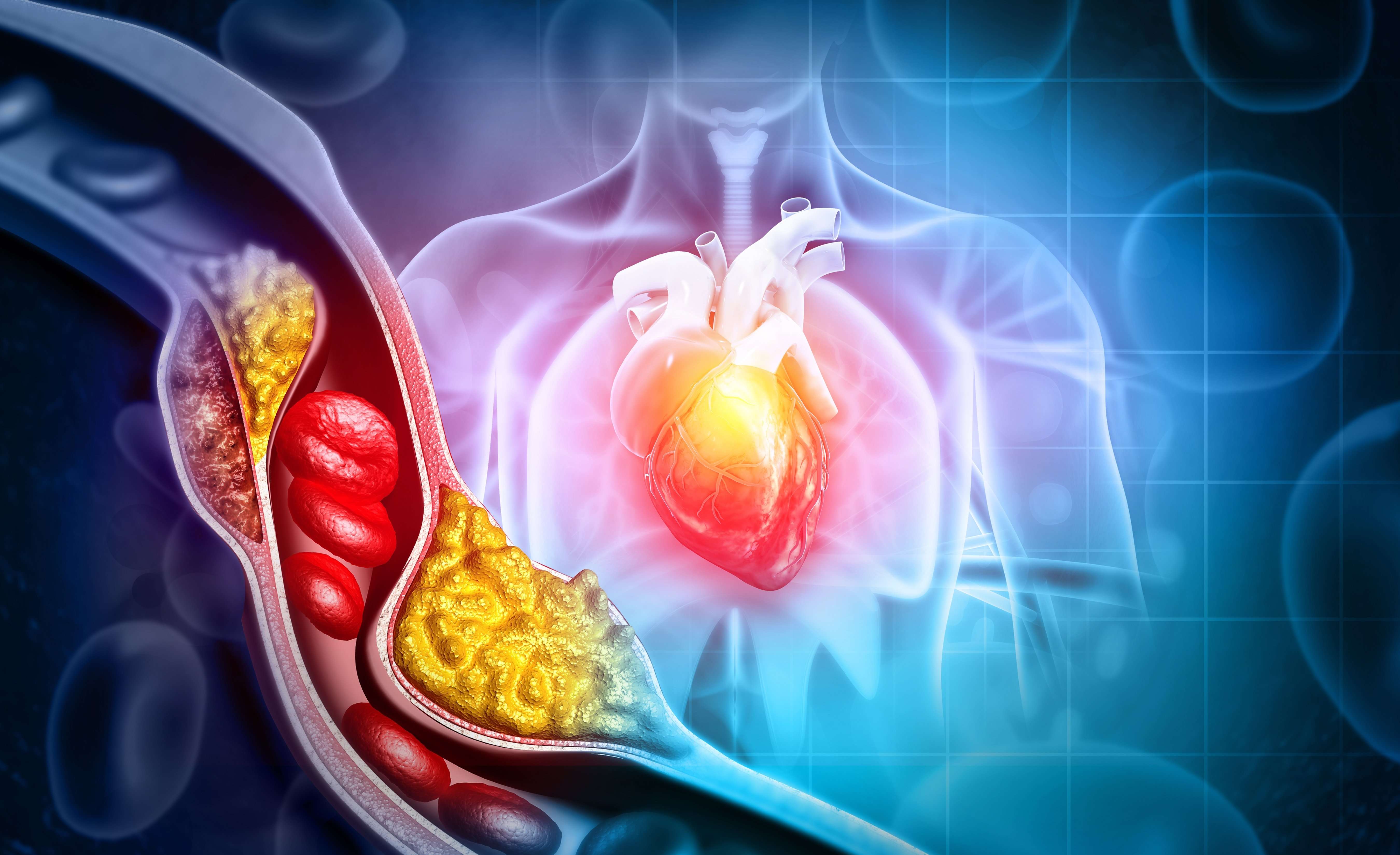 How To Cut Cholesterol In Half