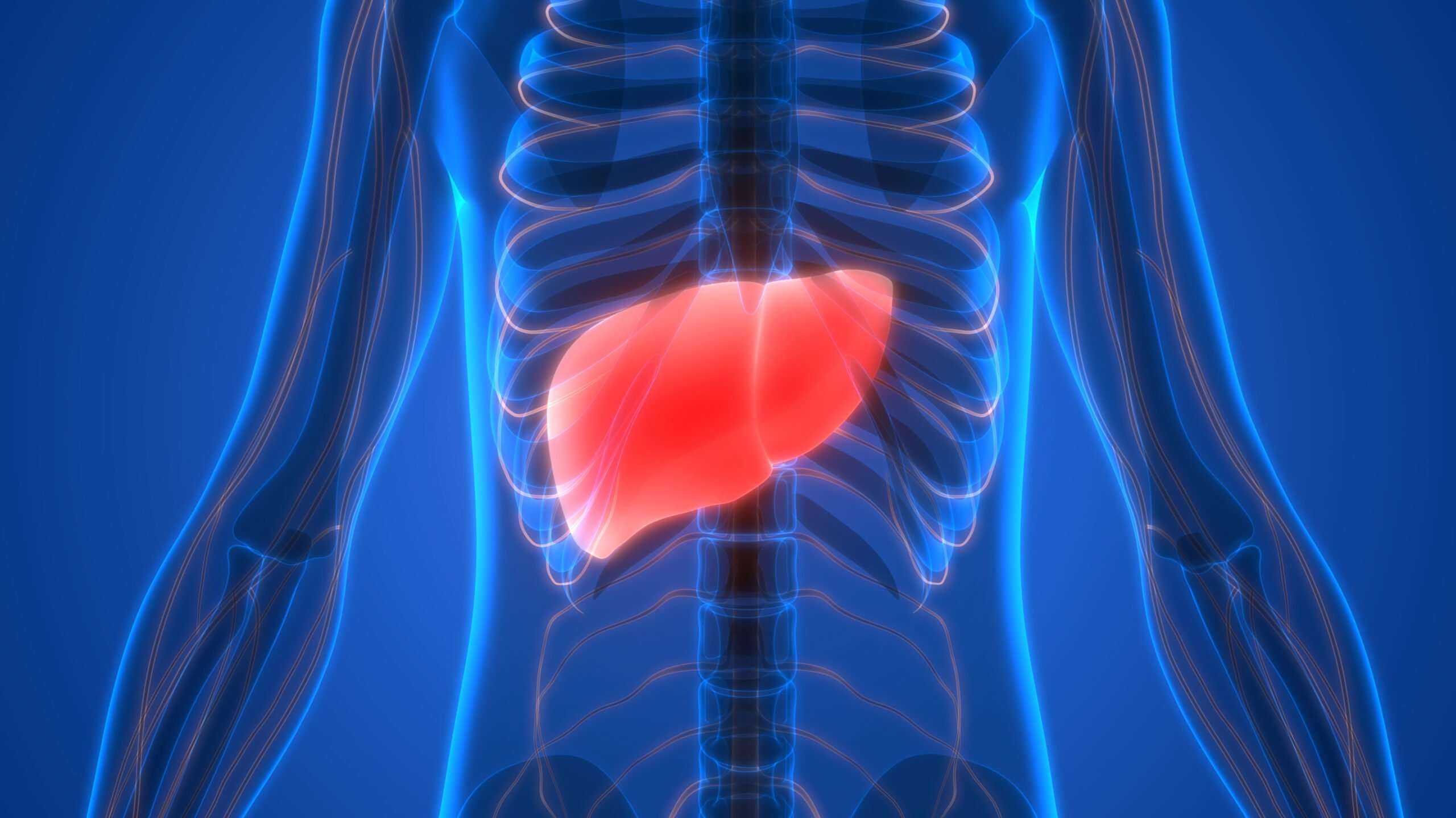 what is NAFLD