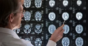 A medical professional examining a series of brain MRI scans displayed on a screen, pointing at specific areas to analyze neurological structures and potential abnormalities.