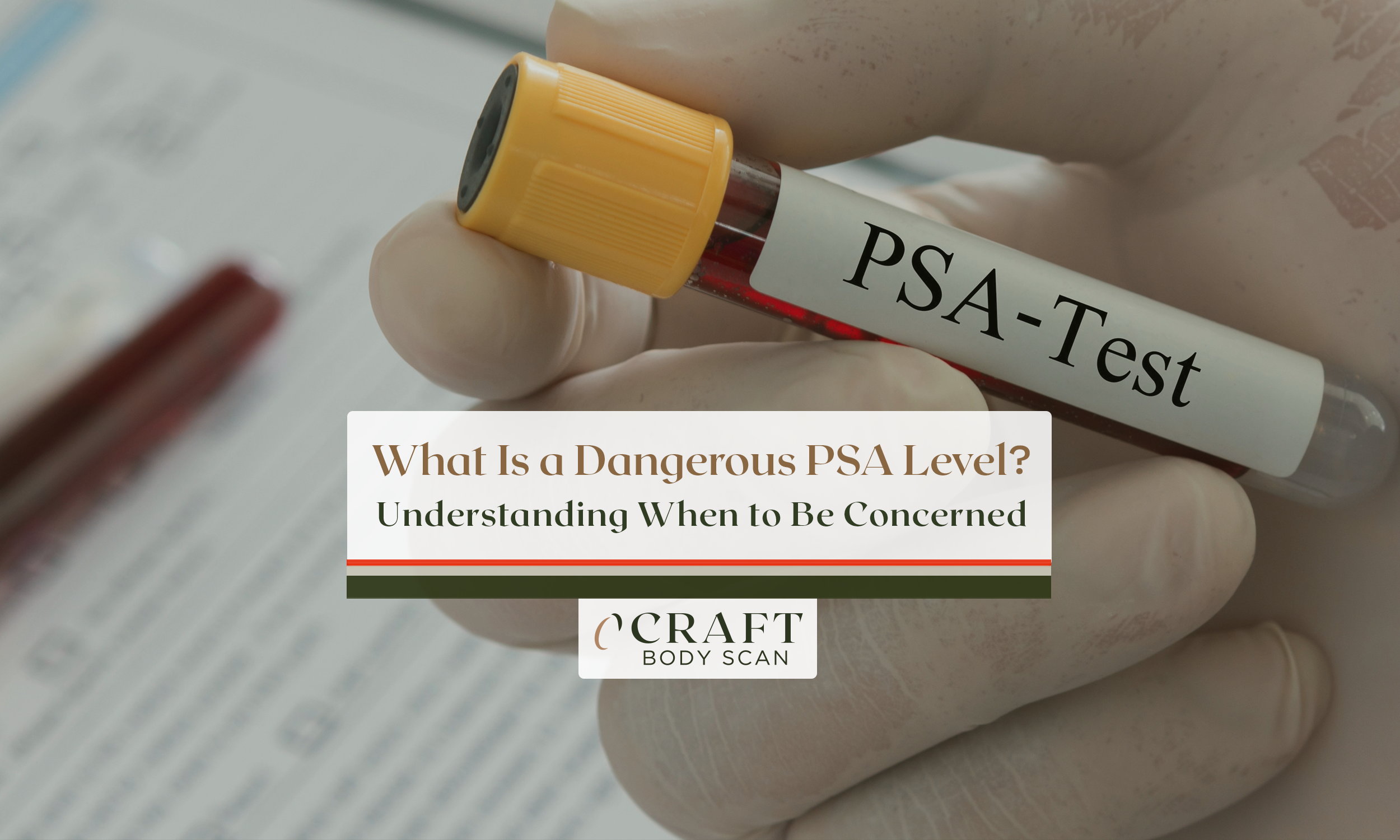 The image focuses on a medical context, specifically relating to prostate health and PSA testing. A gloved hand is holding a yellow-labeled blood collection tube labeled 'PSA-Test'.