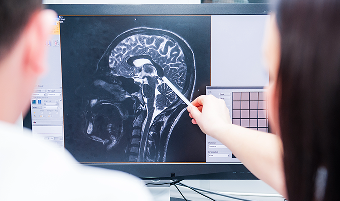 Normal brain MRI showing healthy gray matter, white matter, and symmetrical brain structures