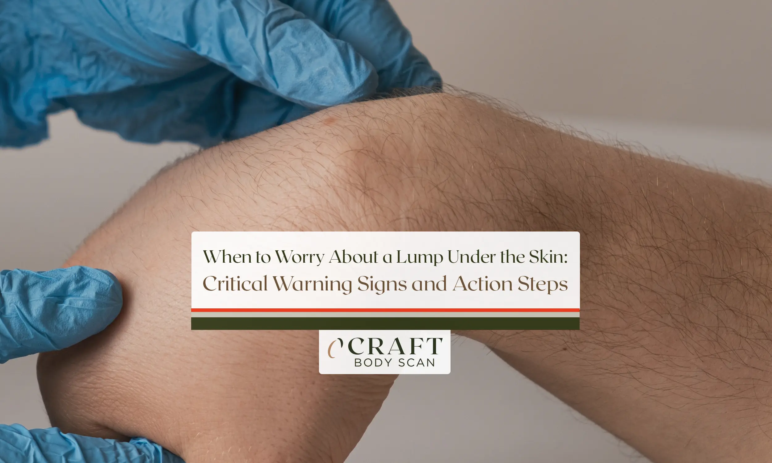 Medical guide showing when to worry about a lump under skin with warning signs requiring doctor evaluation